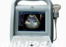 Vand ecograf doppler color