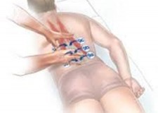 Curs Tehnica presopunctura Tsubo