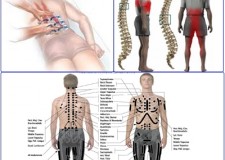 Curs Tehnica Presopunctura Tsubo