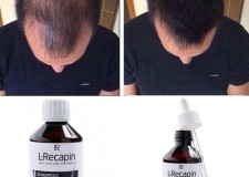 Set  L-Recapin 1+1 prevenirea cÄƒderii pÄƒrului ÅŸi regenerare